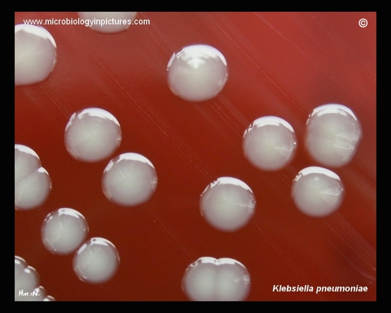 colonies of K.pneumoniae
